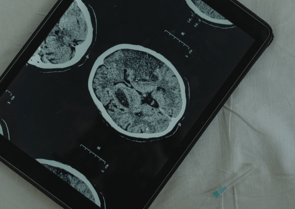 Cannibalism – A Forensic Psychology&nbsp;Analysis